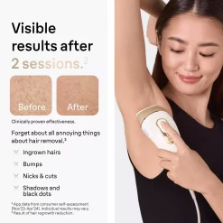 Braun - Pro5 PL5147 IPL Hair Removal Kit for Men & Women - White-Gold