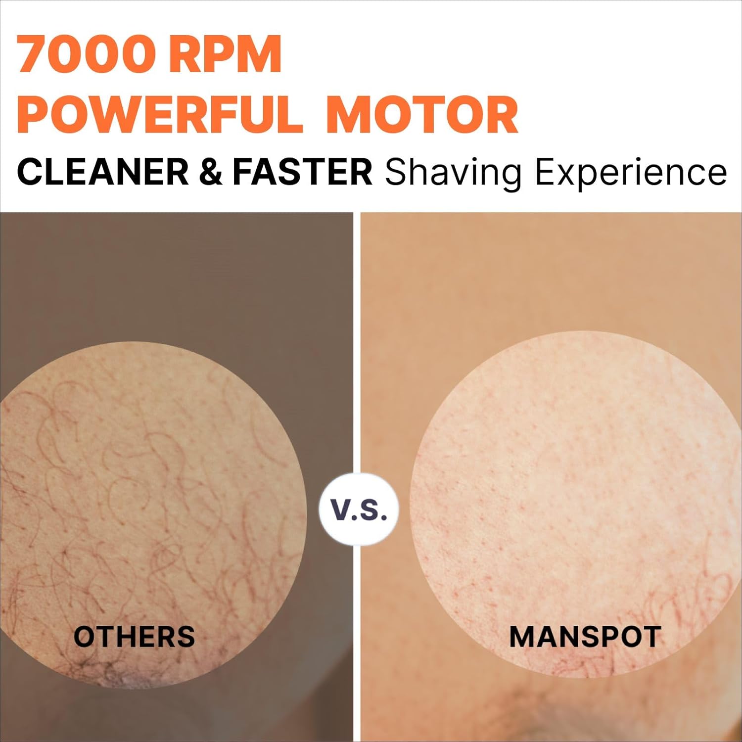 MANSPOT Manscape Groin & Body Hair Trimmer for Men, Electric Ball Trimmer Pubic Trimmer Shaver, Black