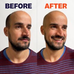 The FlexSeries Electric Head Hair Shaver - Freebird - Ultimate Mens Cordless Rechargeable Wet/Dry Skull & Bald Head Waterproof Razor