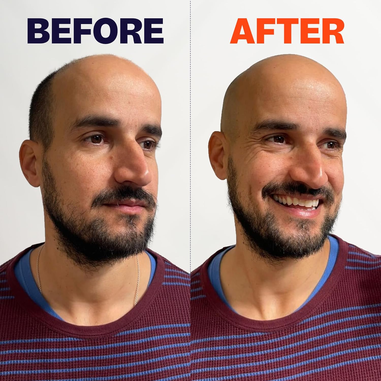 The FlexSeries Electric Head Hair Shaver - Freebird - Ultimate Mens Cordless Rechargeable Wet/Dry Skull & Bald Head Waterproof Razor